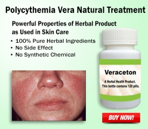 Natural Treatment for Polycythemia Vera